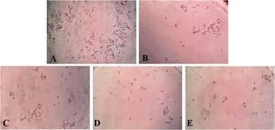 Inhibitory activity of Enhydra fluctuans Lour. on calcium oxalate crystallisation through in silico and in vitro studies